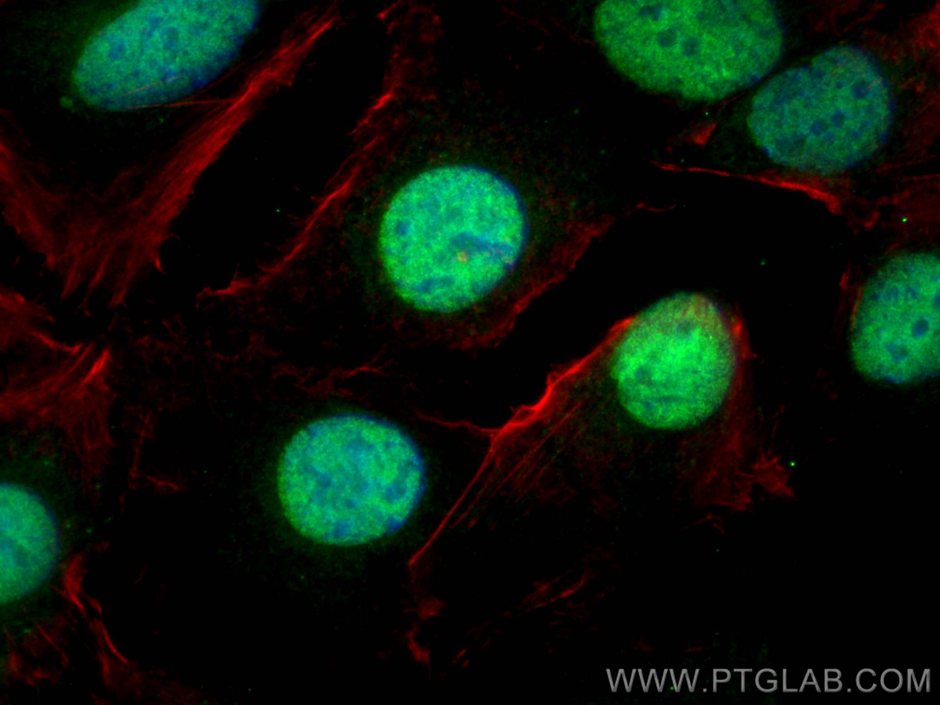 IF Staining of SKOV-3 using 10336-1-AP