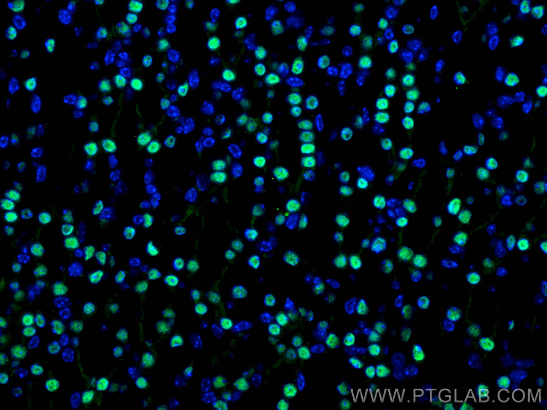 IF Staining of mouse kidney using 10336-1-AP