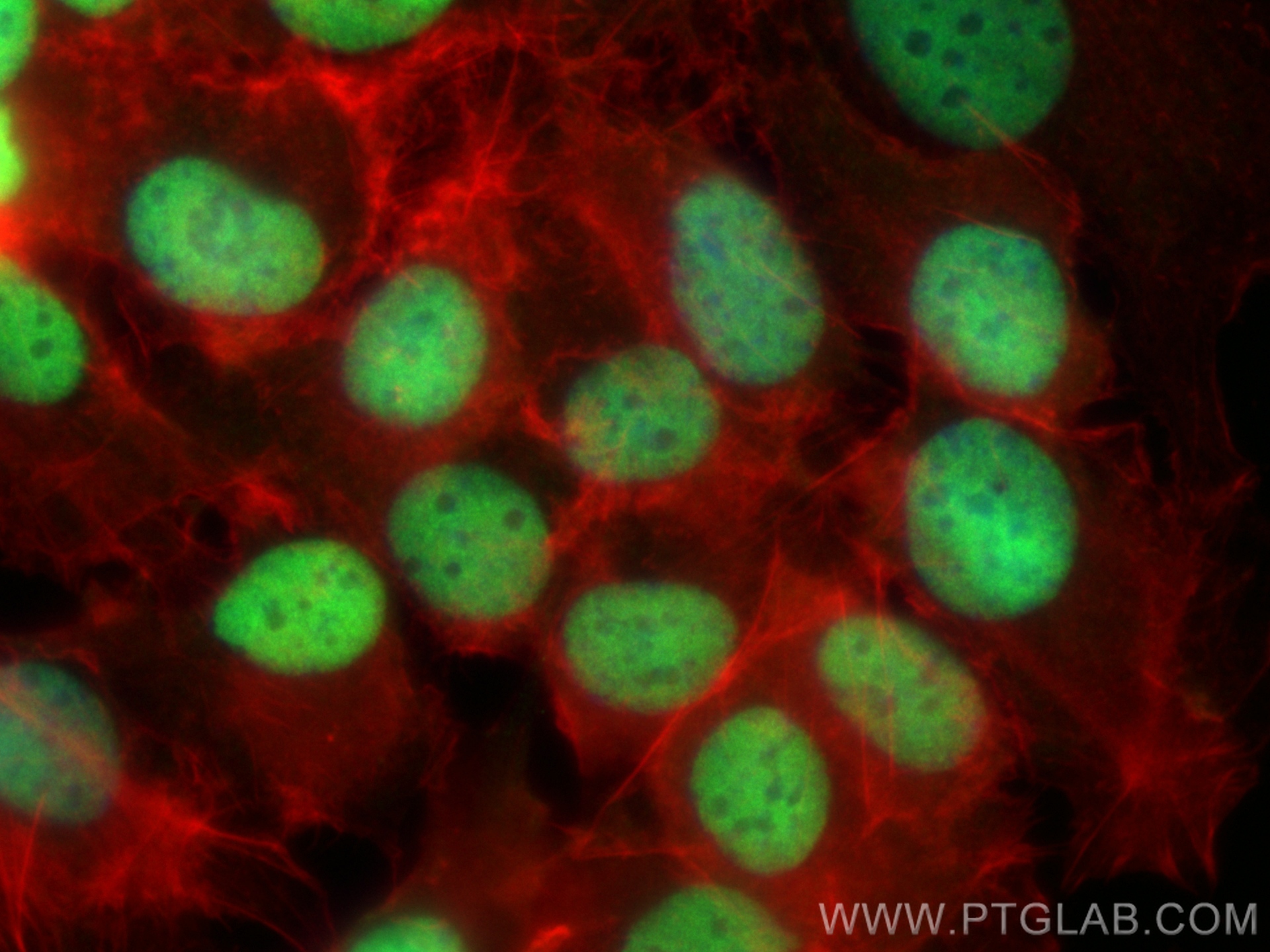 IF Staining of SKOV-3 using CL488-10336