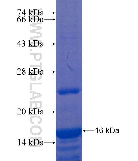 PAX8 fusion protein Ag20348 SDS-PAGE