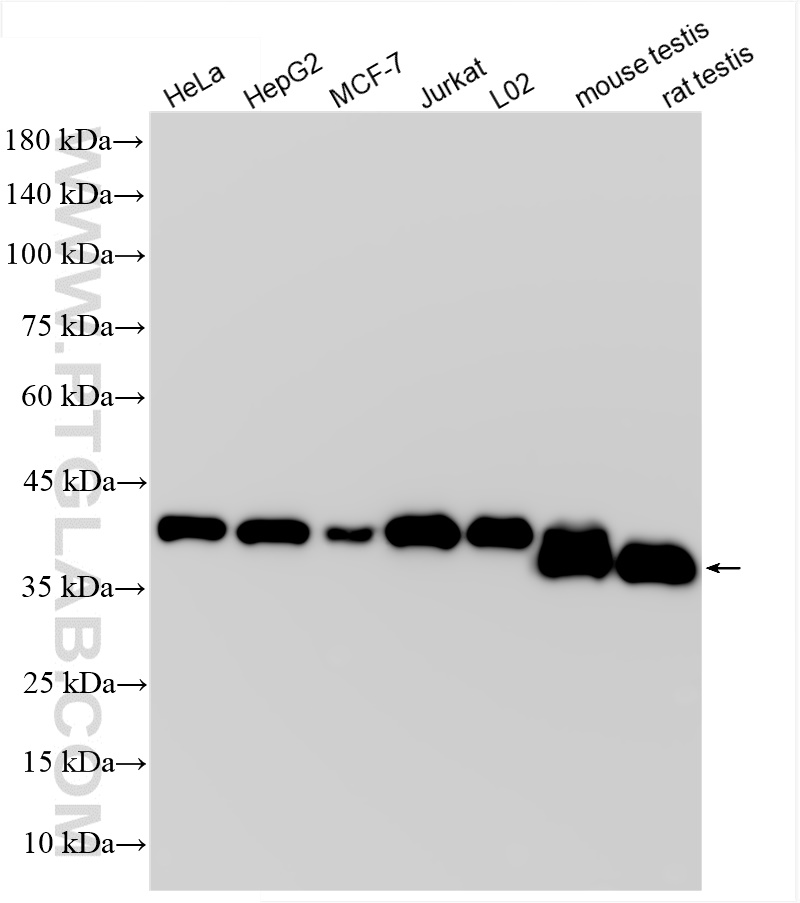 WB analysis using 84970-1-RR (same clone as 84970-1-PBS)