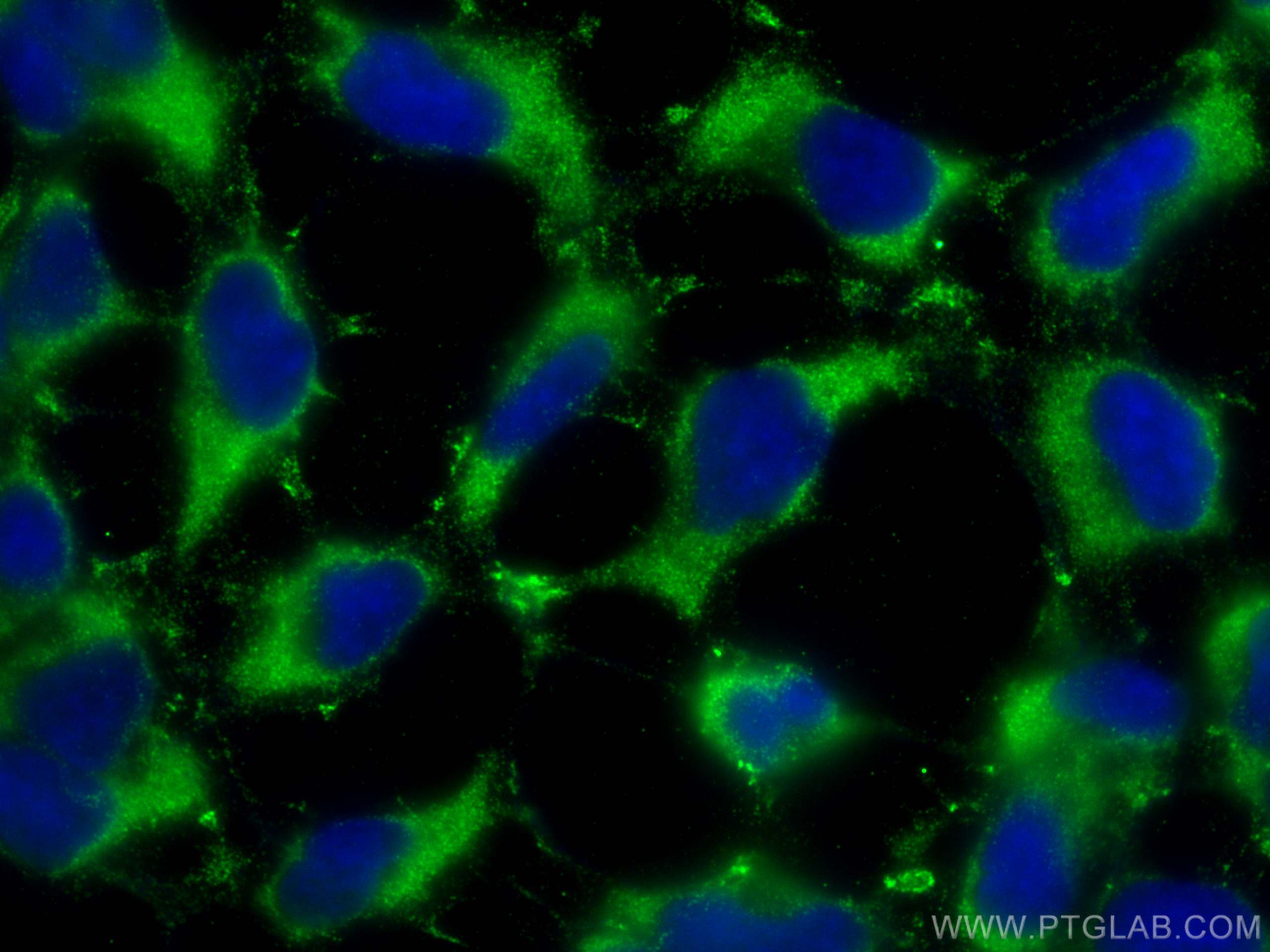 IF Staining of HEK-293 using 68317-1-Ig