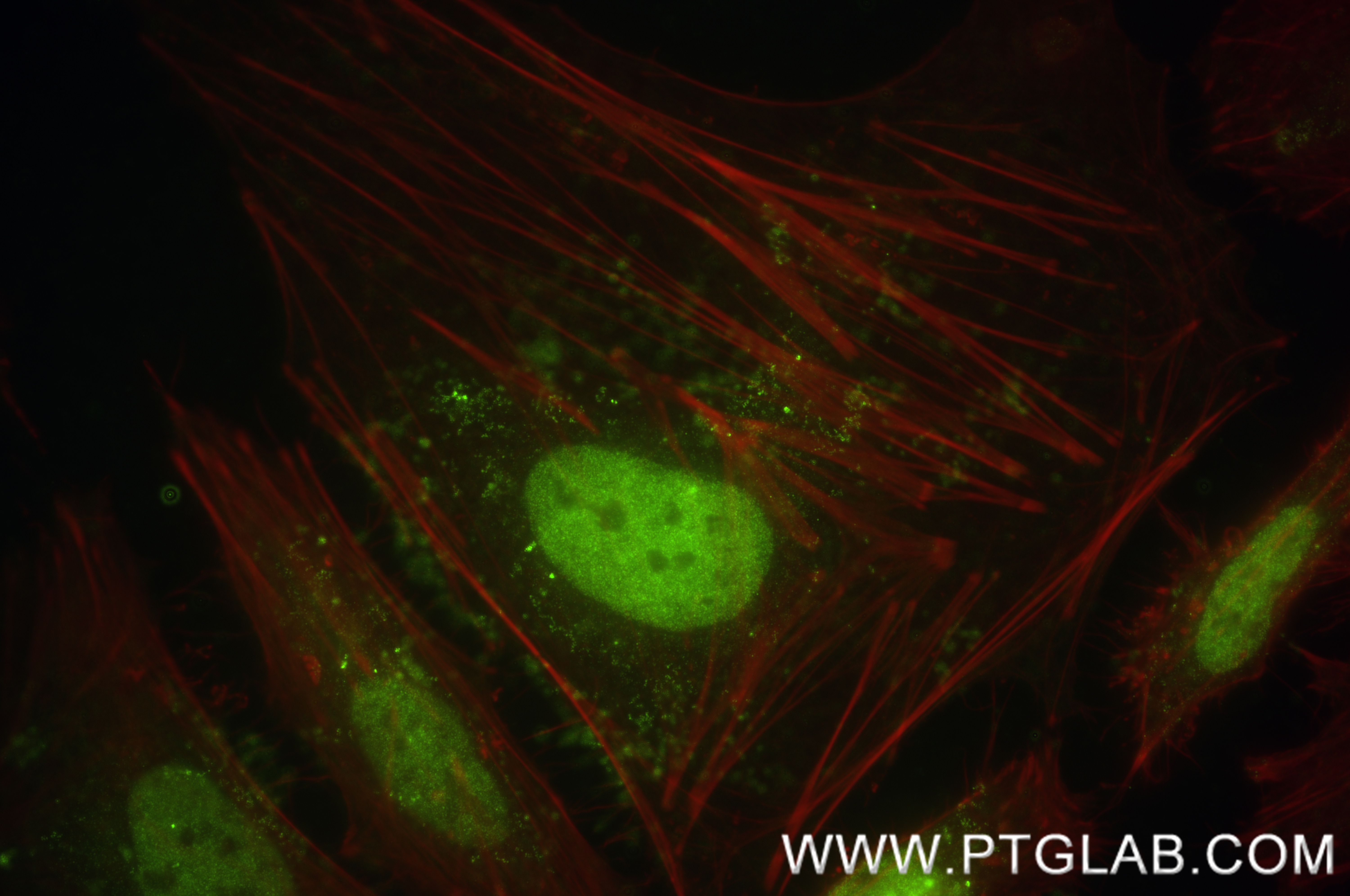 IF Staining of HeLa using 83677-2-RR