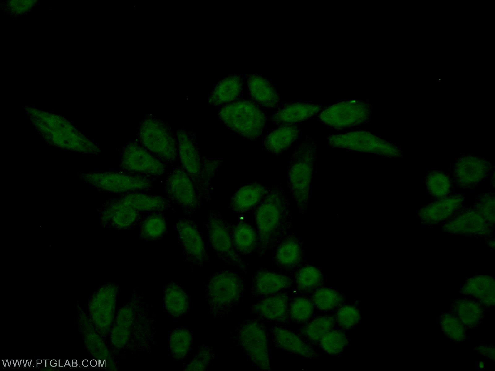IF Staining of HeLa using 18204-1-AP