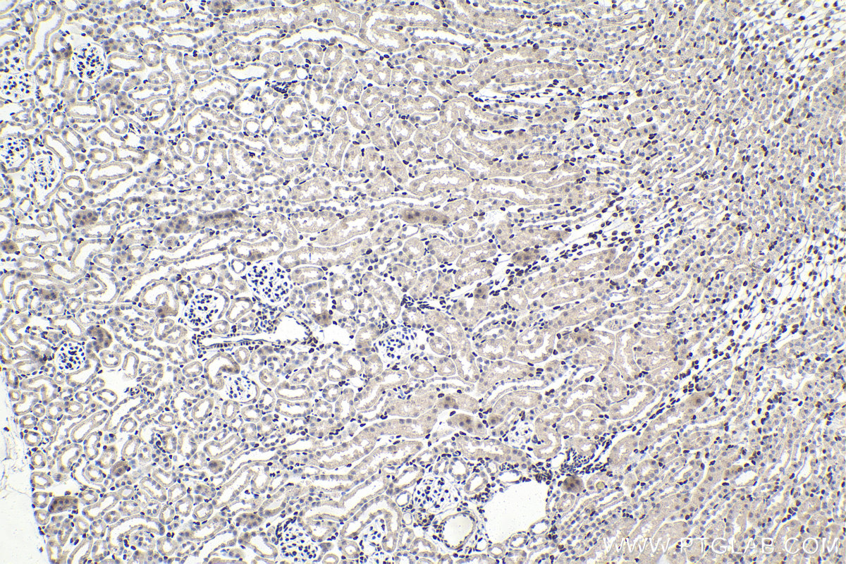 IHC staining of mouse kidney using 18204-1-AP