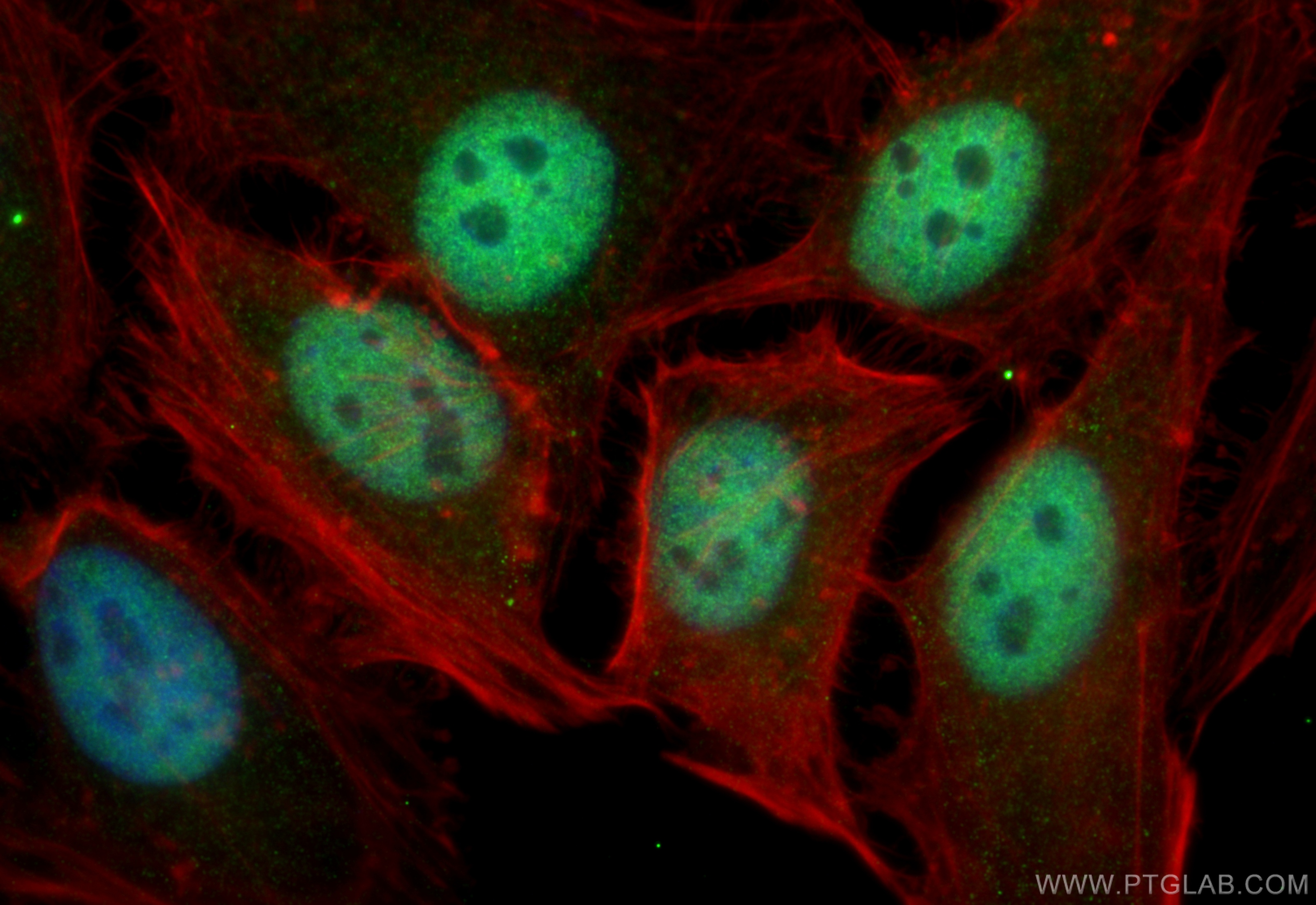 IF Staining of HeLa using 12571-1-AP