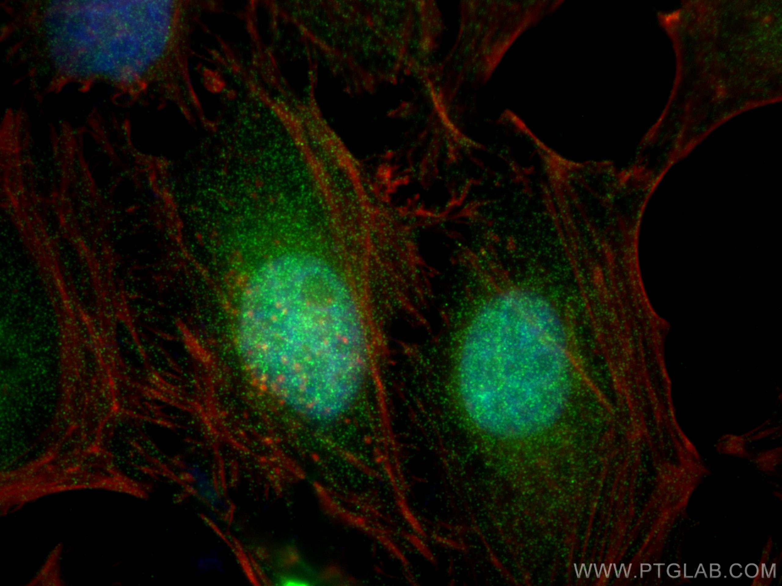 IF Staining of HeLa using 15702-1-AP