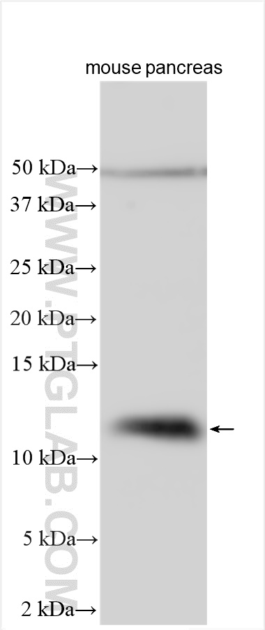 WB analysis using 15702-1-AP