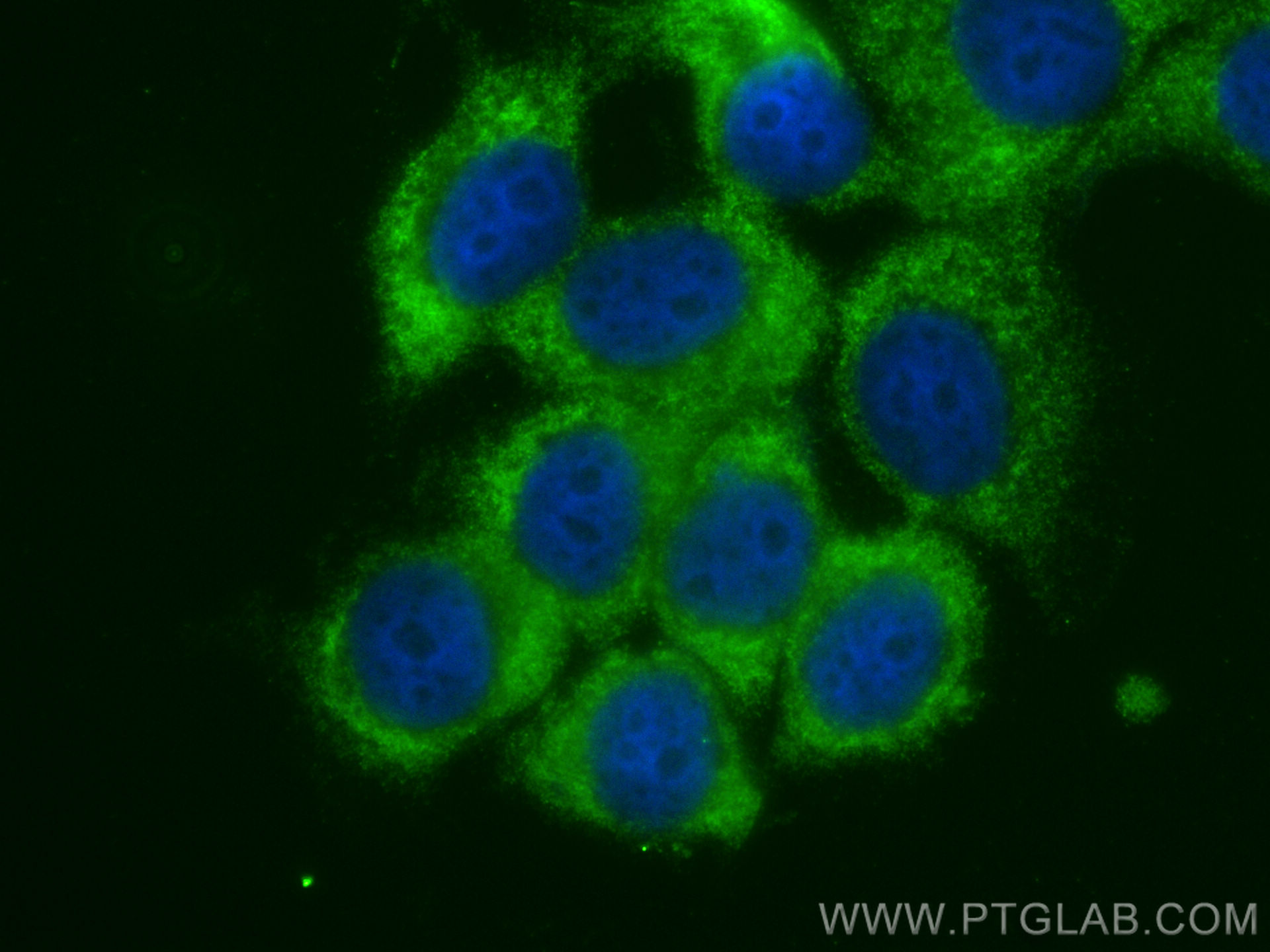 IF Staining of MCF-7 using 16141-1-AP