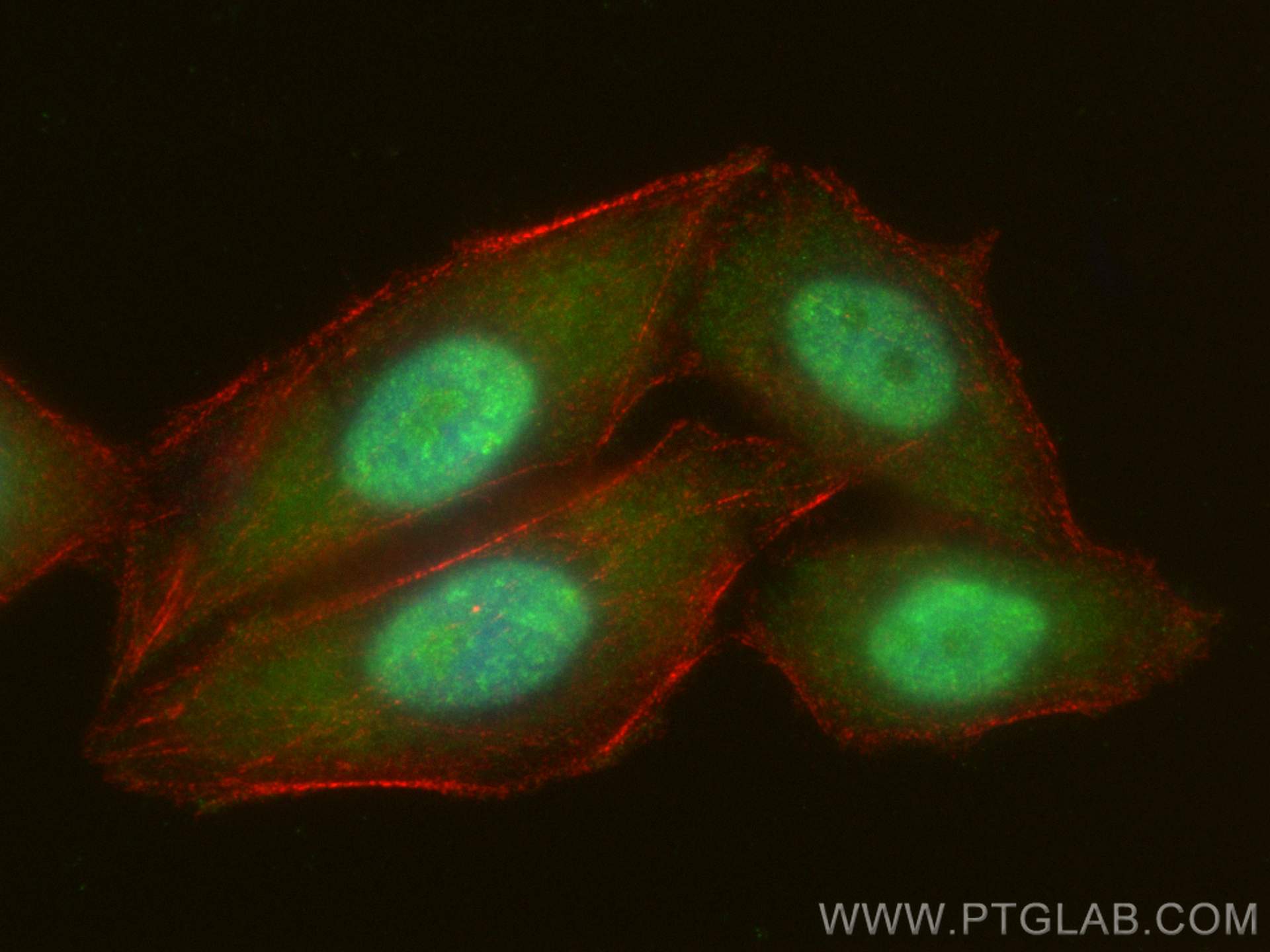 IF Staining of HepG2 using 21988-1-AP