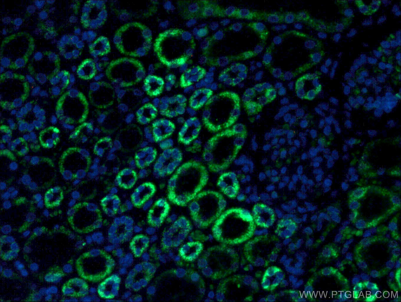 IF Staining of human kidney using 11139-1-AP