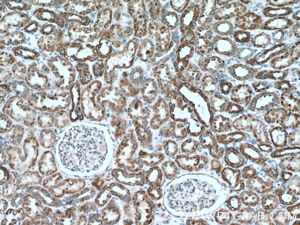 IHC staining of human kidney using 11139-1-AP