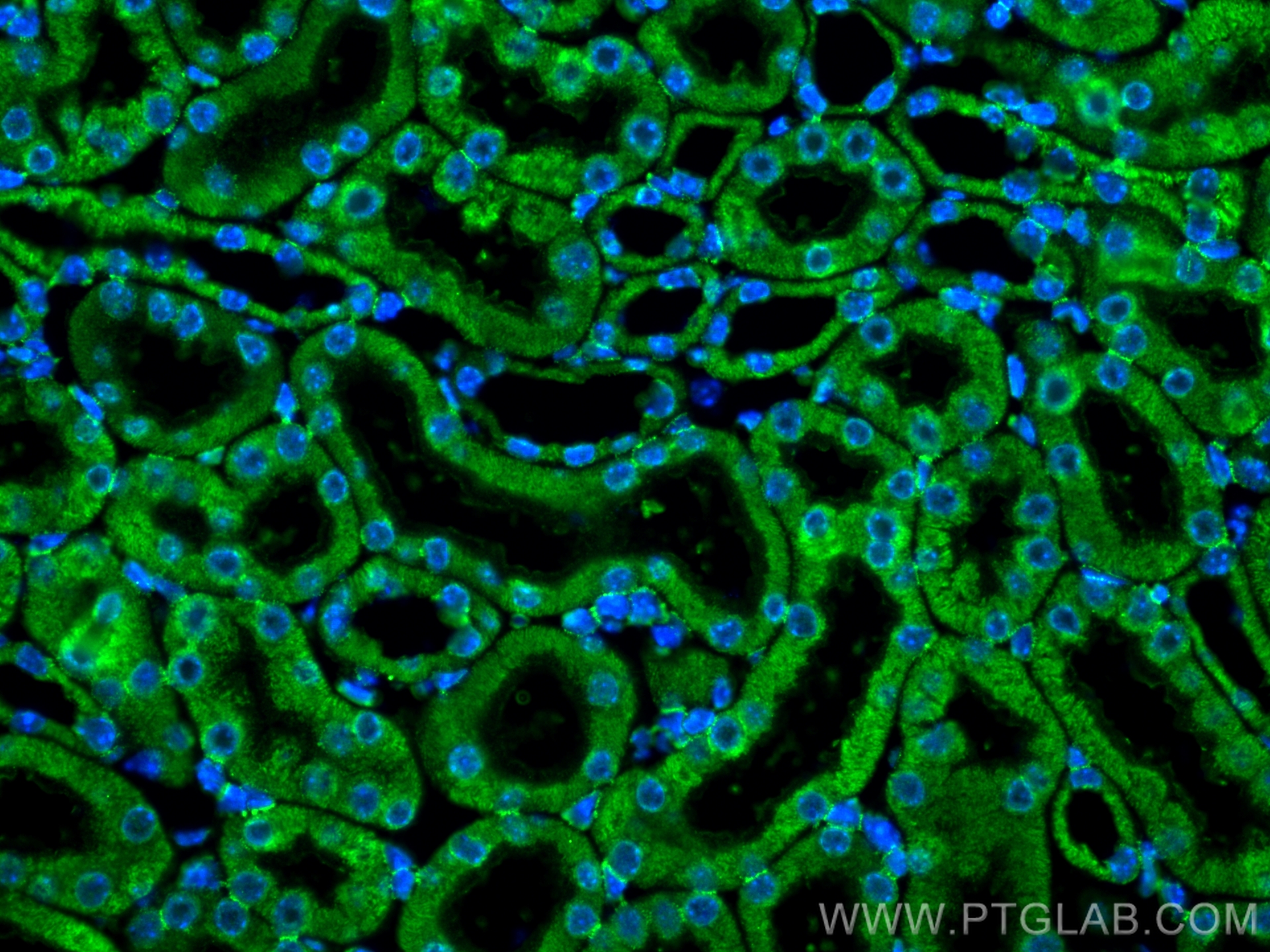 IF Staining of mouse kidney using 66501-1-Ig