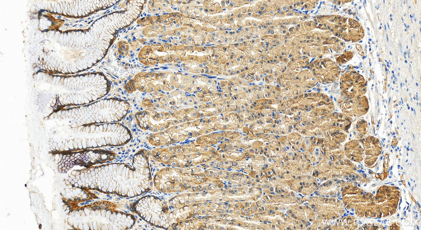 IHC staining of human stomach using 13645-1-AP