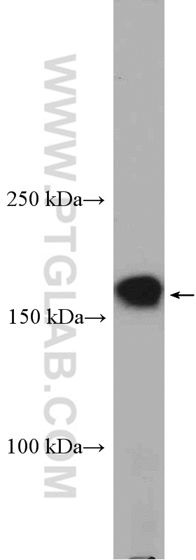 WB analysis of mouse brain using 25090-1-AP