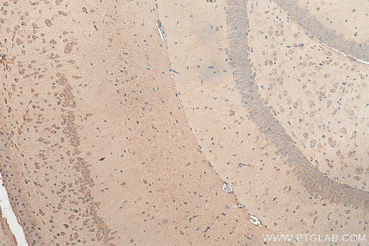 IHC staining of mouse brain using 18803-1-AP