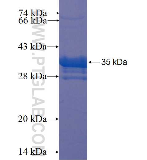 PCDHB14 fusion protein Ag22859 SDS-PAGE