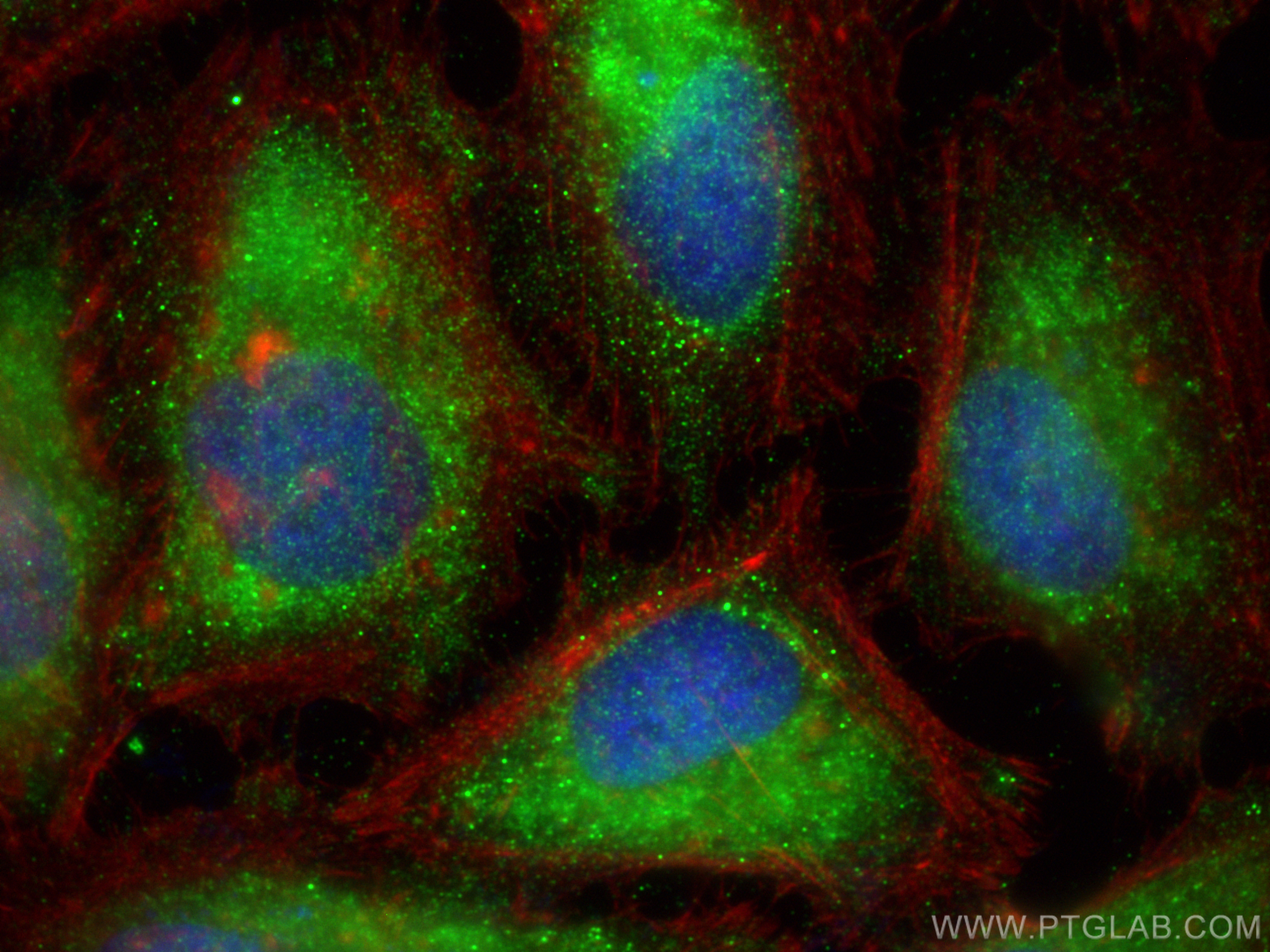 IF Staining of HeLa using 21204-1-AP