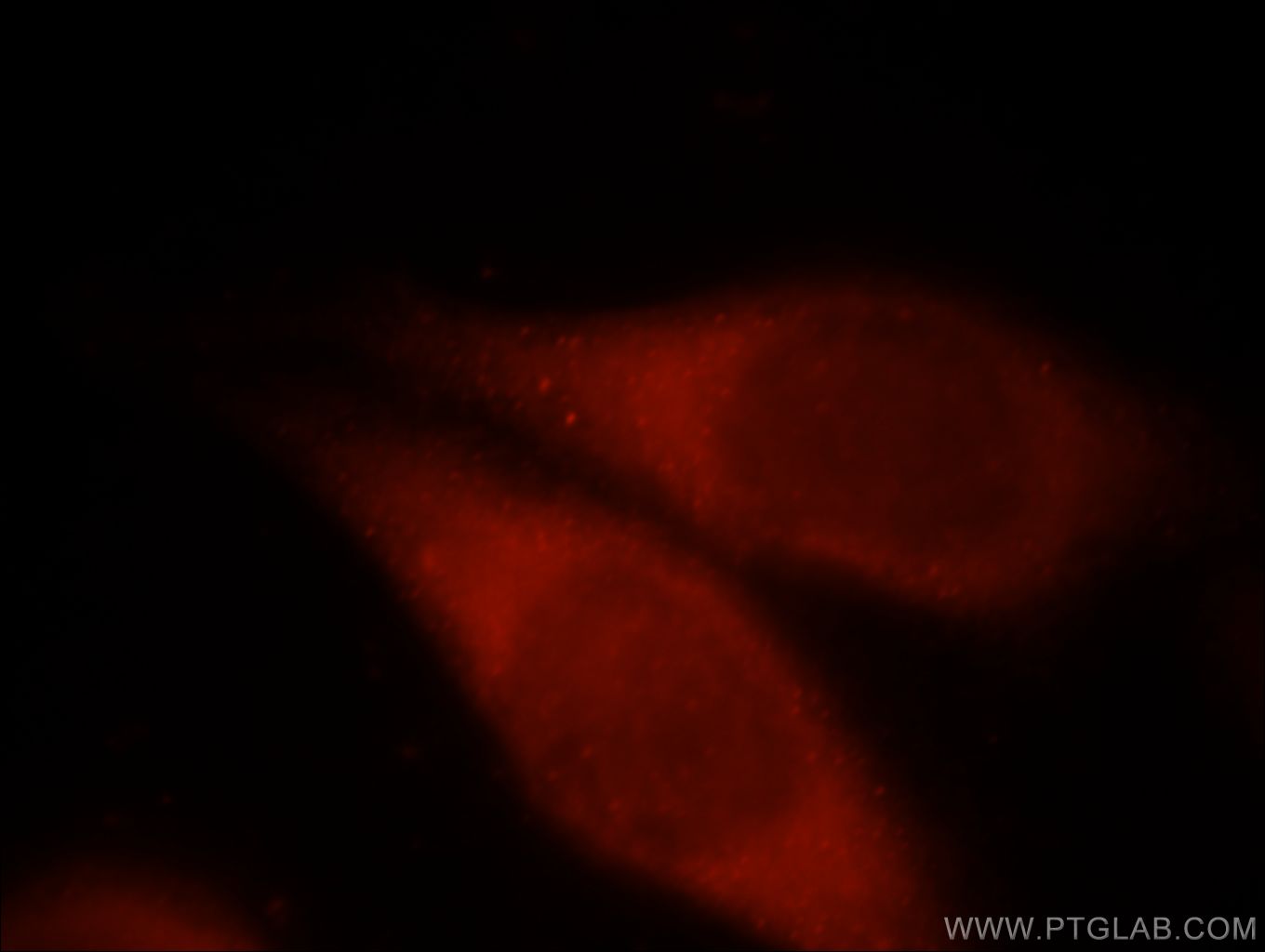 IF Staining of HeLa using 21204-1-AP