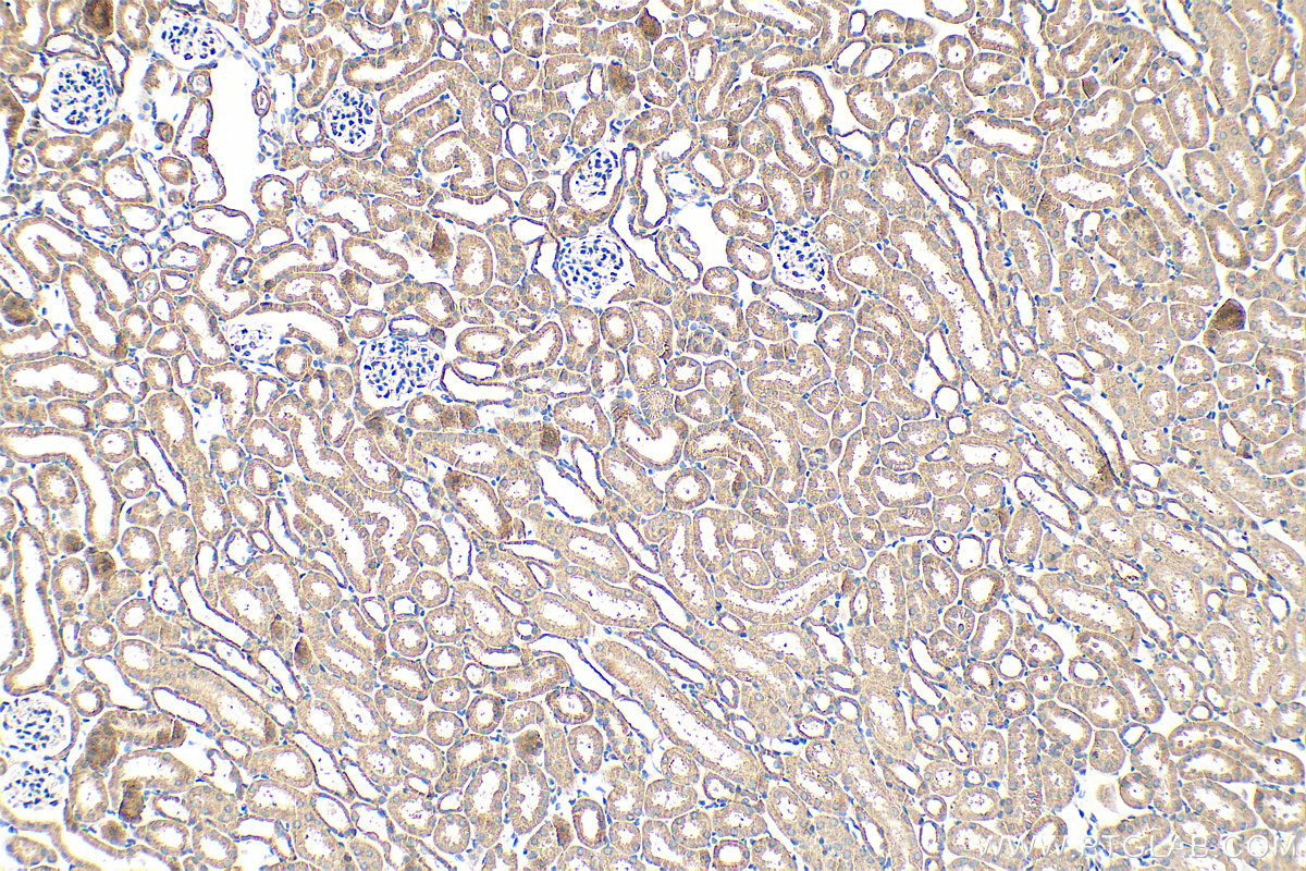 IHC staining of mouse kidney using 21204-1-AP