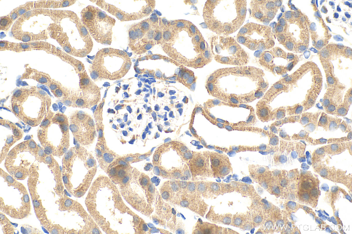 IHC staining of mouse kidney using 21204-1-AP