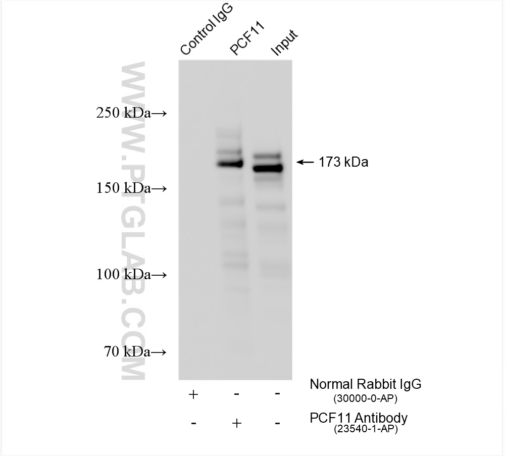 IP experiment of K-562 using 23540-1-AP