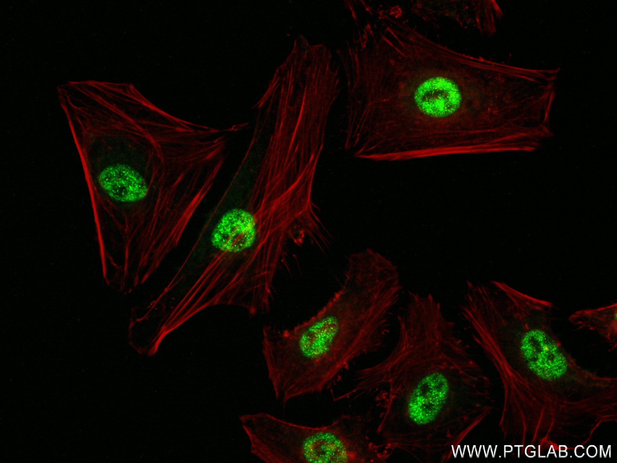 IF Staining of HeLa using 84081-5-RR (same clone as 84081-5-PBS)