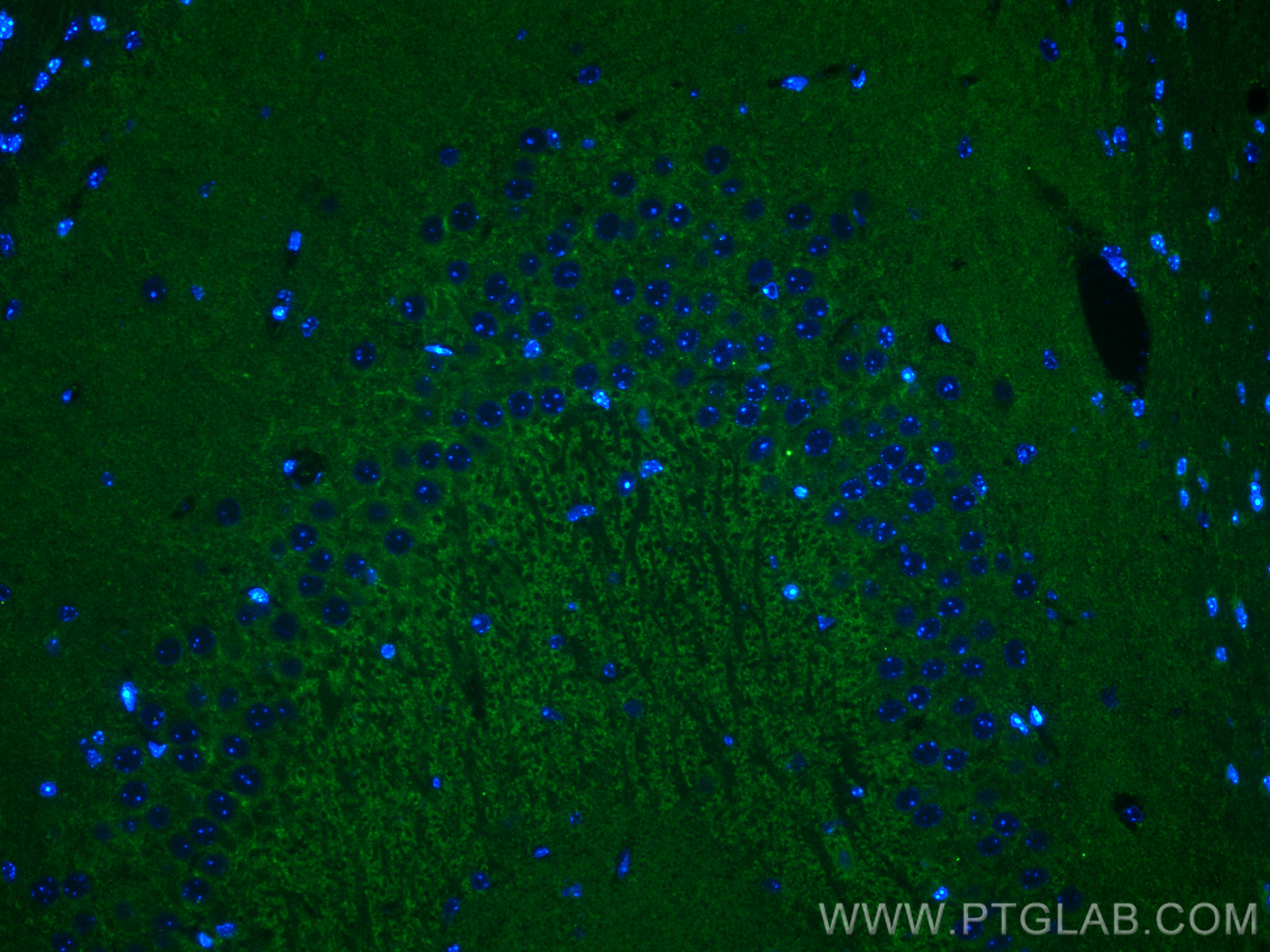 IF Staining of mouse brain using 18156-1-AP