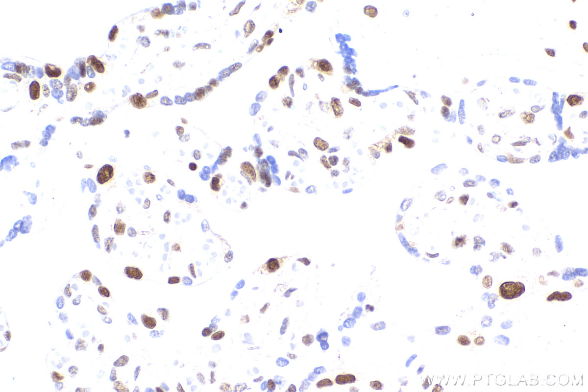 IHC staining of human placenta using 60097-1-Ig