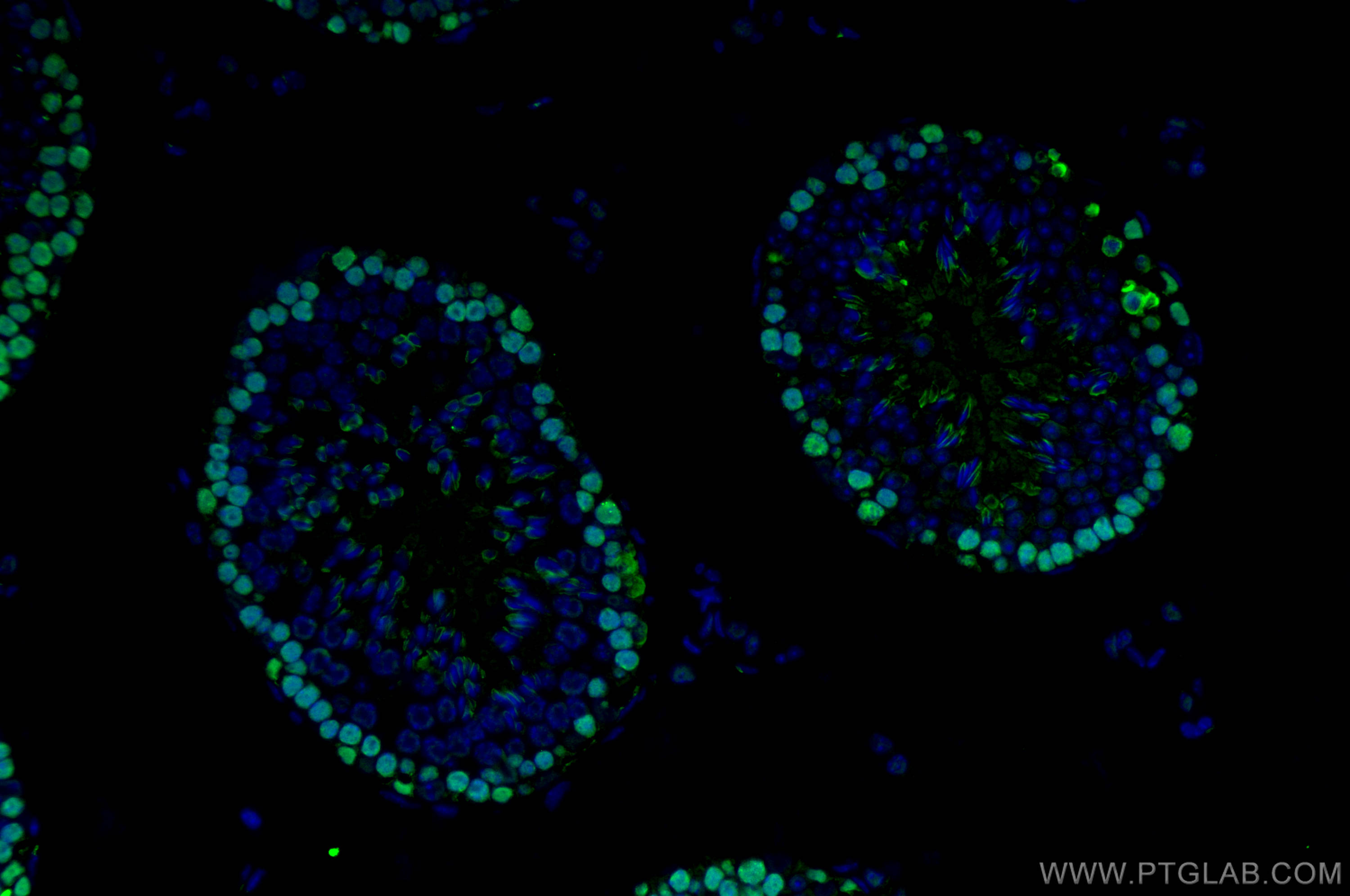 IF Staining of mouse testis using 81302-6-RR
