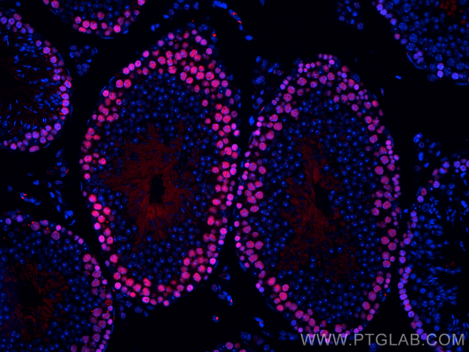 IF Staining of mouse testis using CL594-81302-6