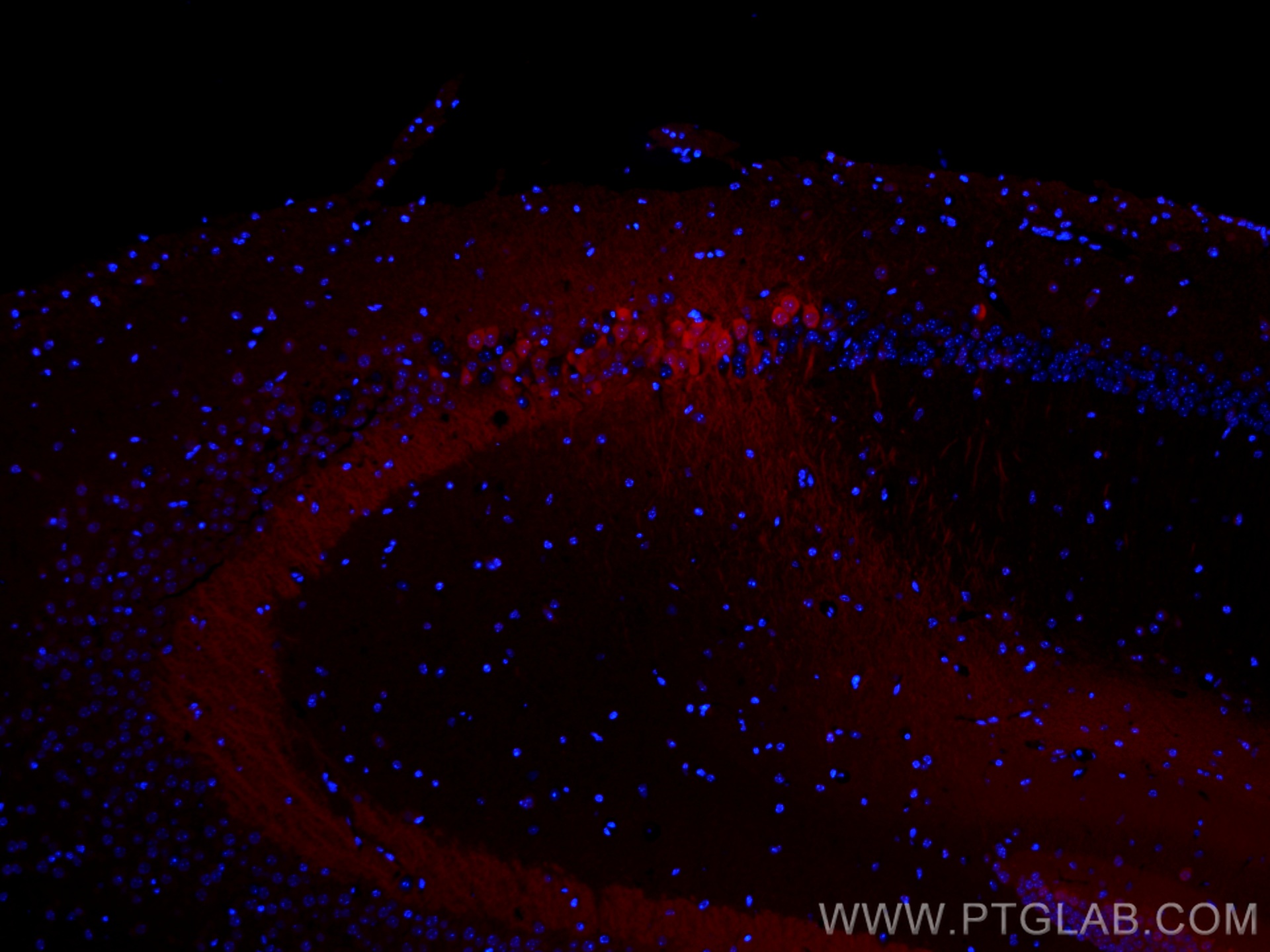 IF Staining of mouse brain using CL594-14705