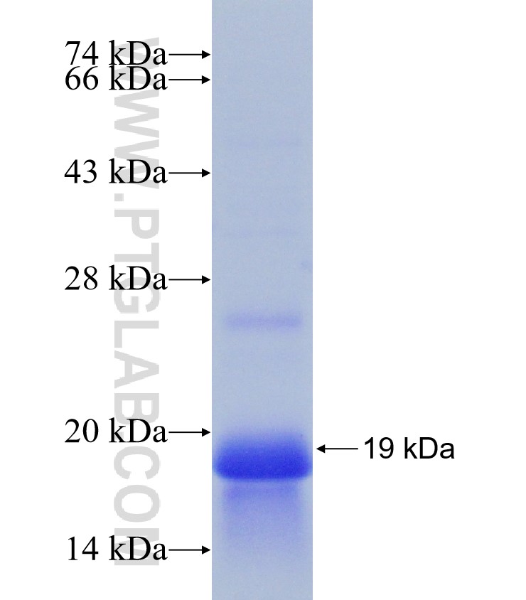 PCP4L1 fusion protein Ag31230 SDS-PAGE