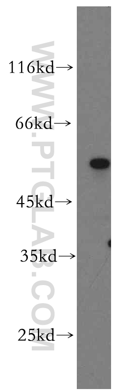 WB analysis of human testis using 15106-1-AP