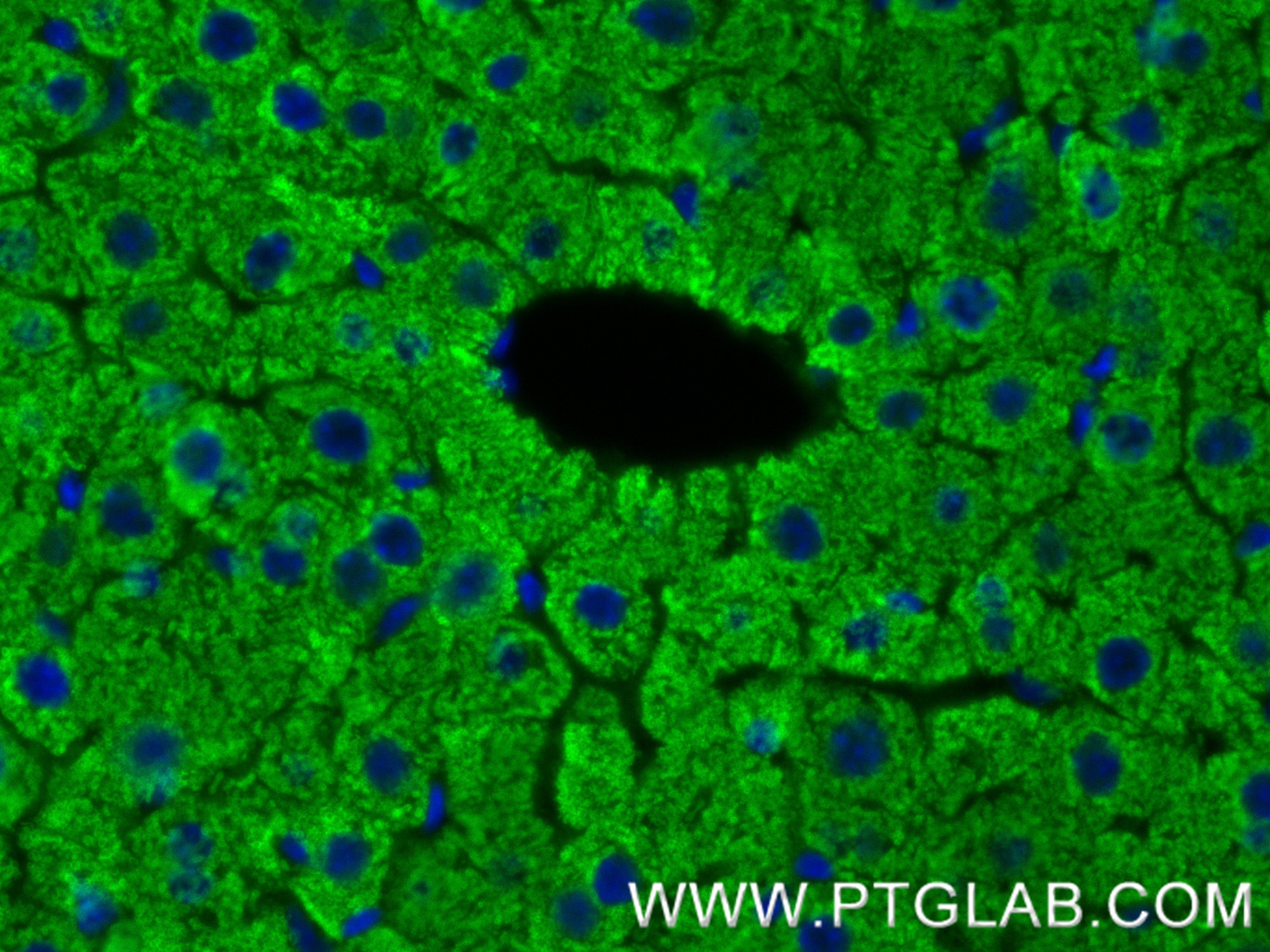 IF Staining of mouse liver using 83004-4-RR