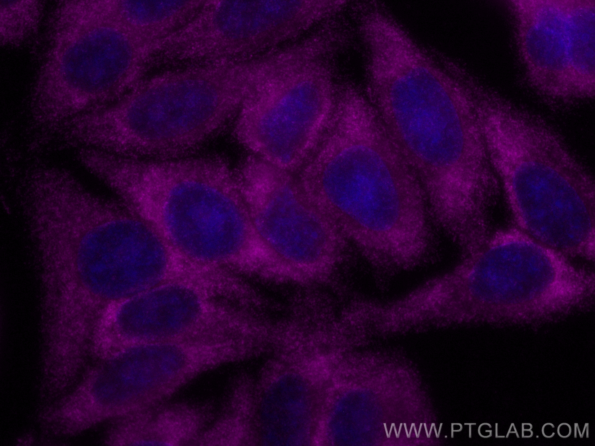 IF Staining of HepG2 using CL647-83004-4