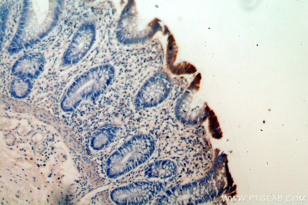 IHC staining of human colon using 18868-1-AP