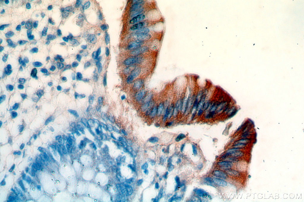 IHC staining of human colon using 18868-1-AP