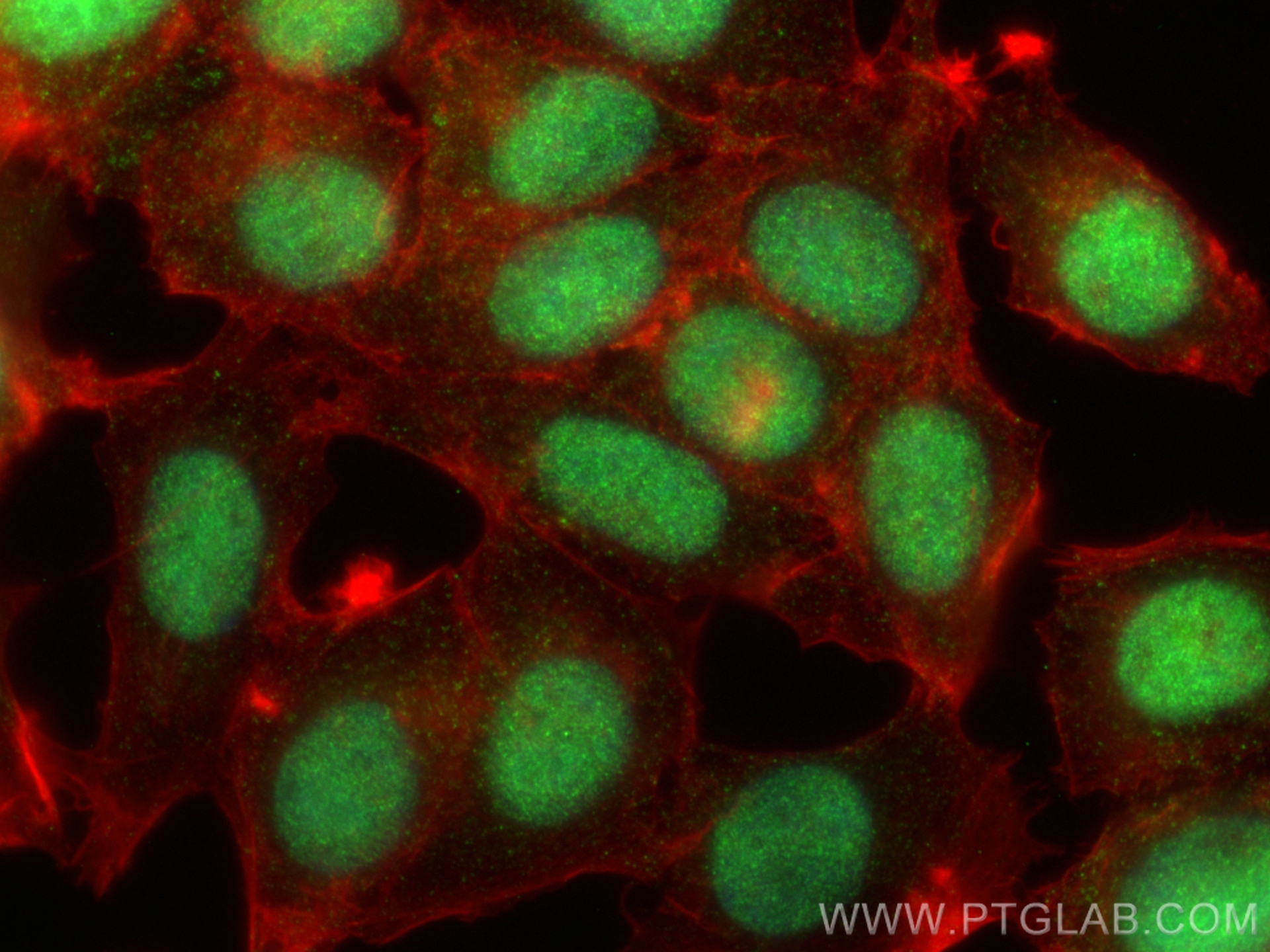 IF Staining of MCF-7 using 83100-1-RR