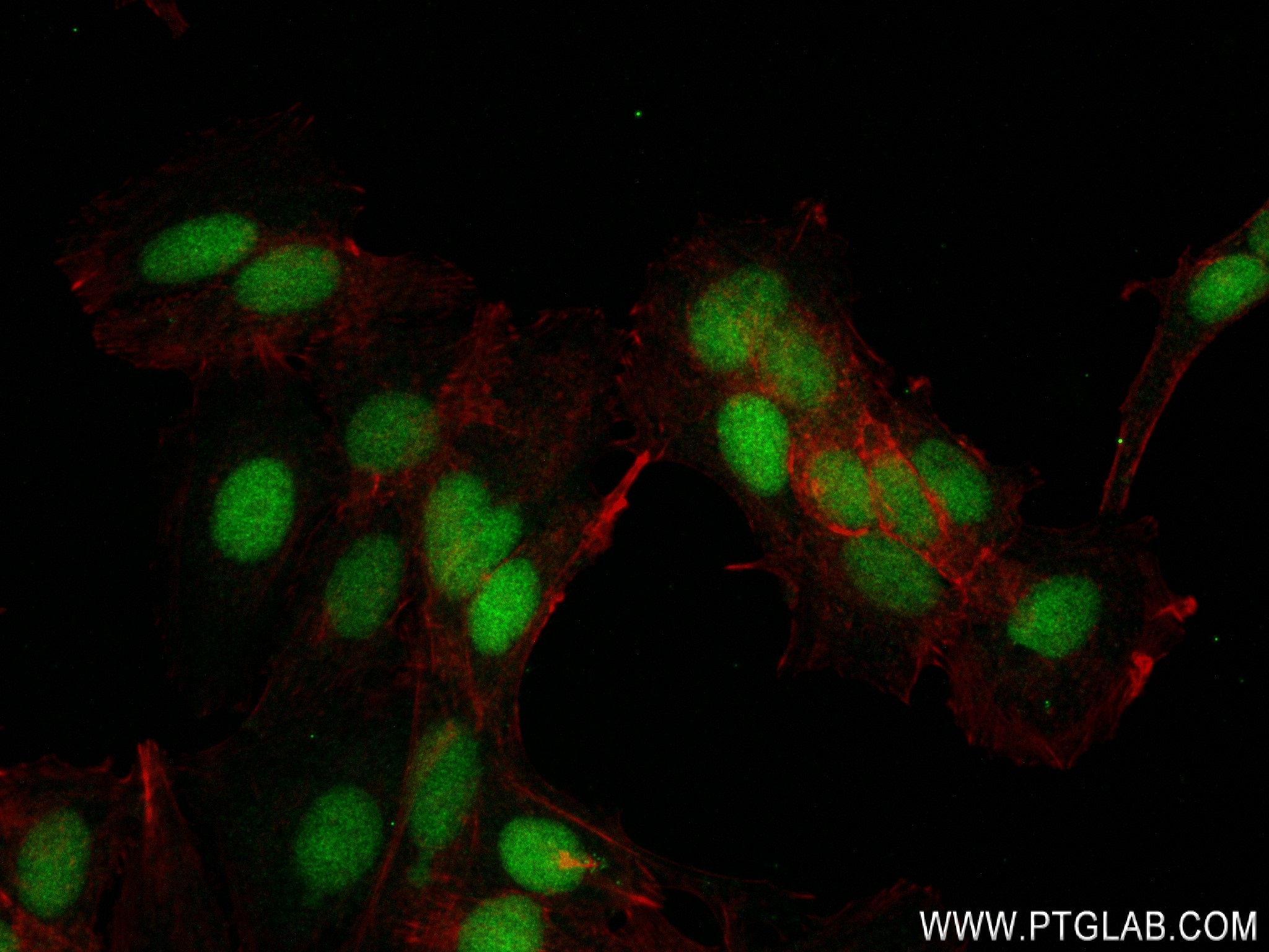 IF Staining of MCF-7 using 83100-1-RR