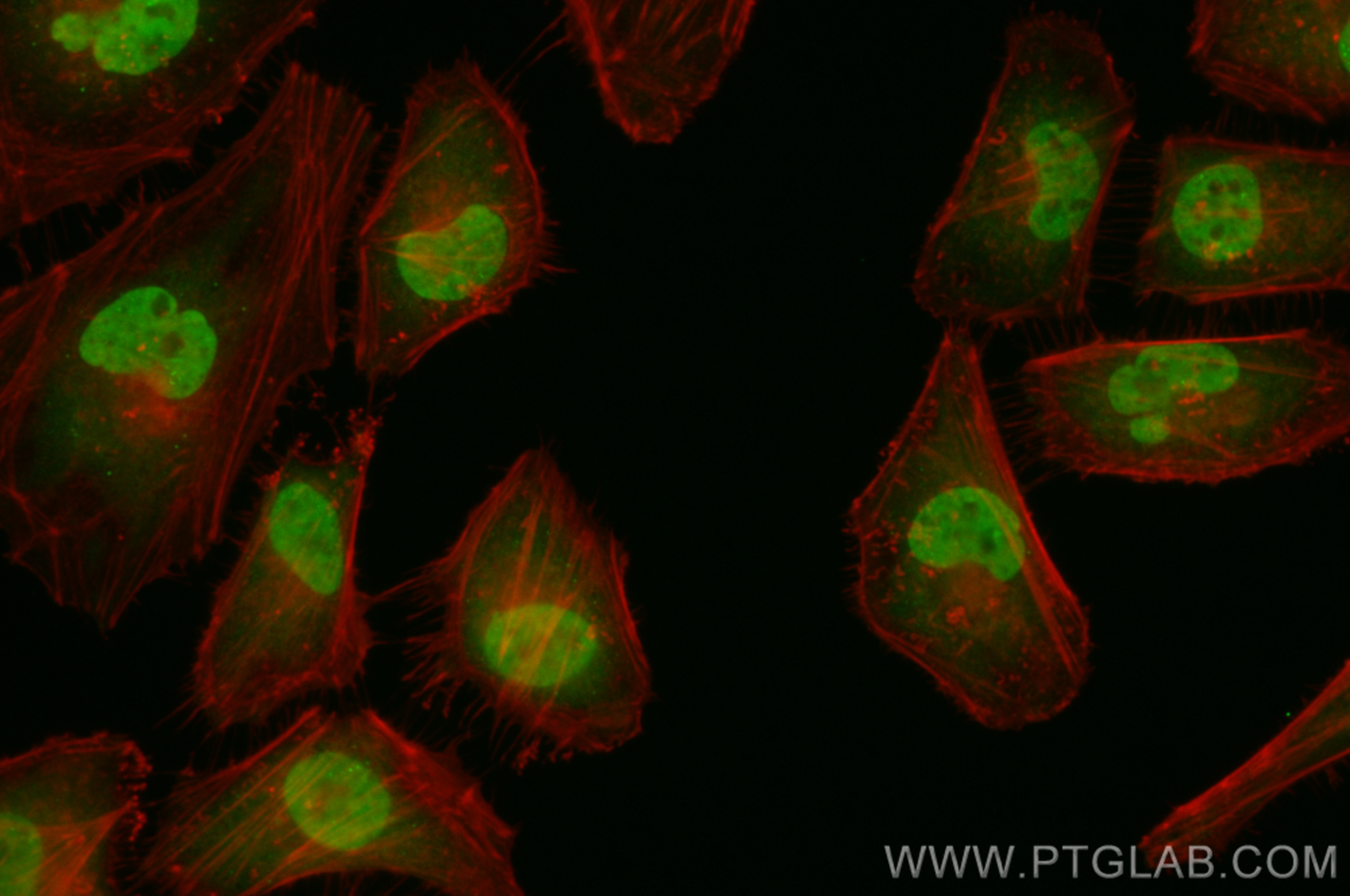 IF Staining of MCF-7 using CL488-83100