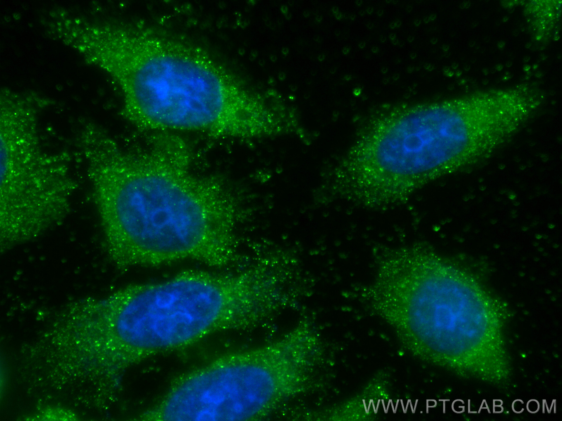 IF Staining of HepG2 using 68355-1-Ig (same clone as 68355-1-PBS)