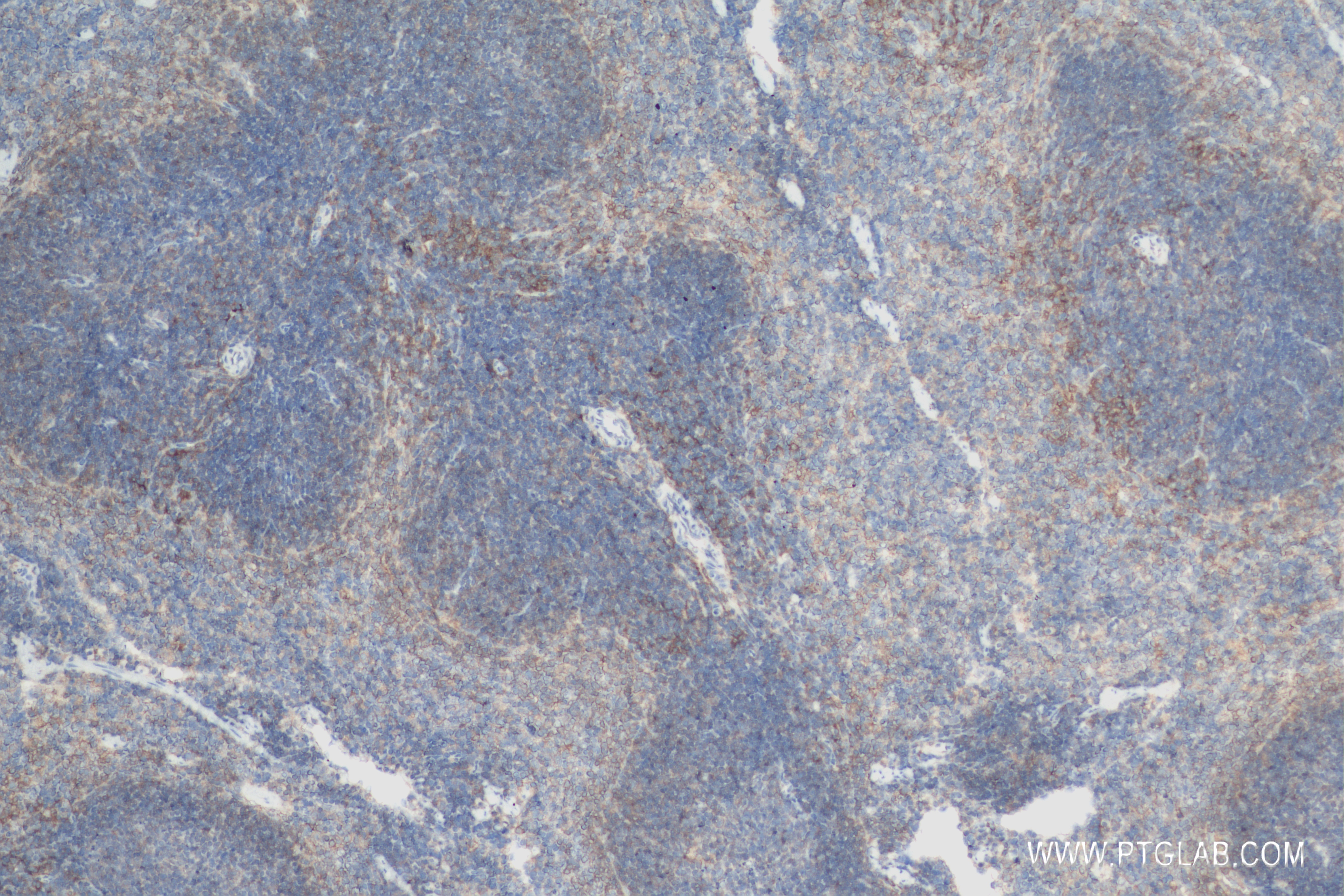 IHC staining of mouse spleen using 83906-6-RR (same clone as 83906-6-PBS)