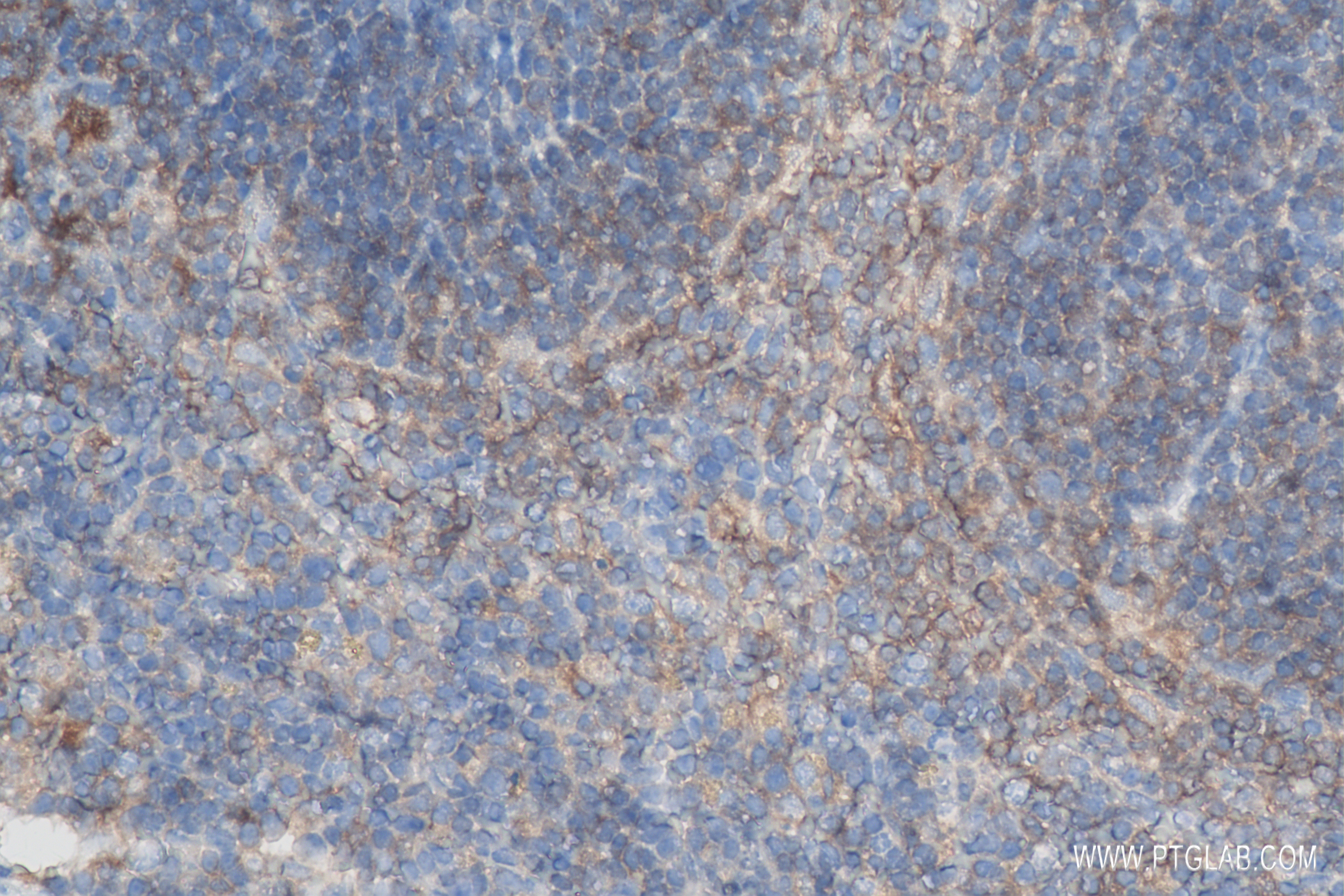 IHC staining of mouse spleen using 83906-6-RR (same clone as 83906-6-PBS)