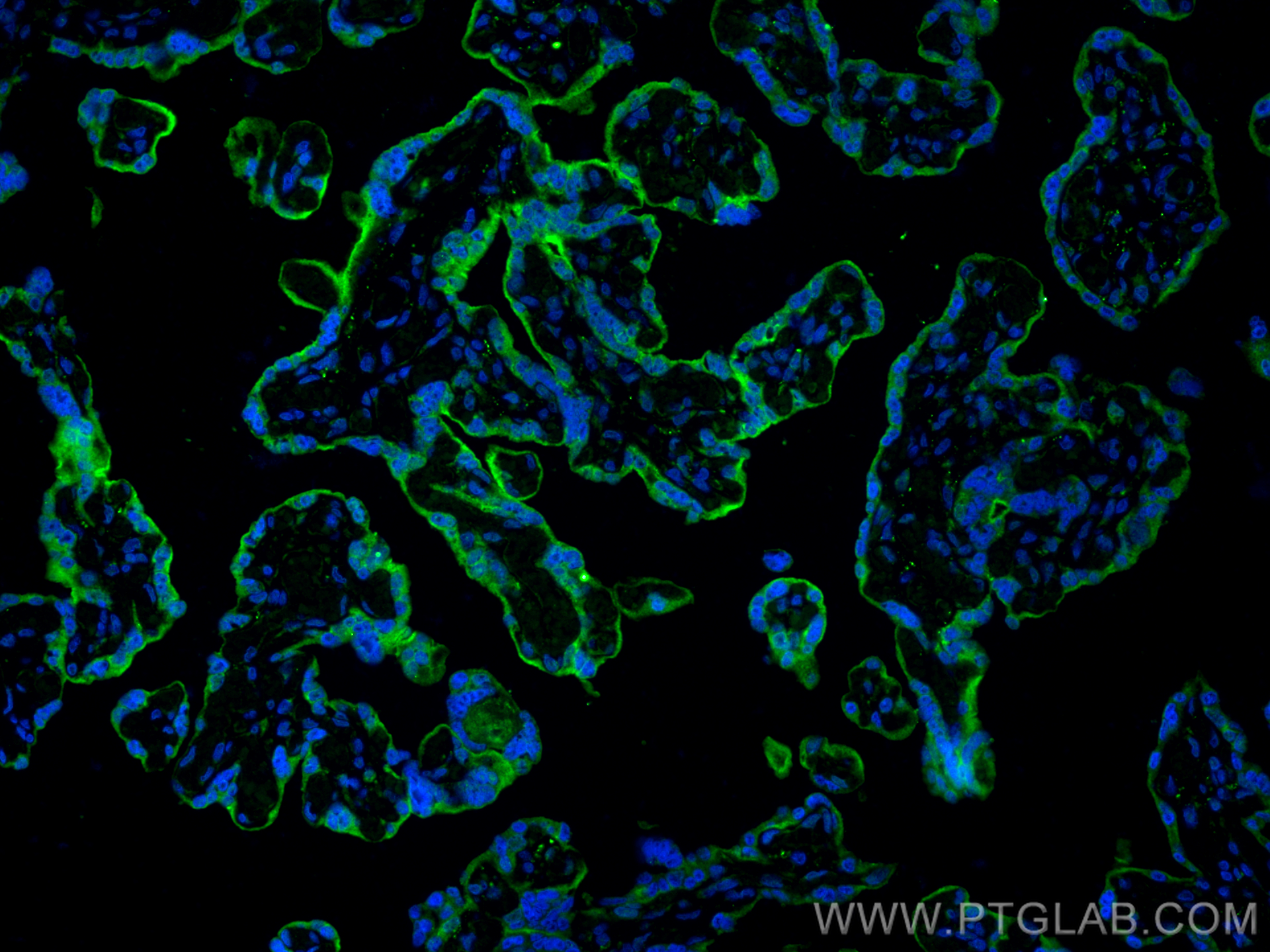 IF Staining of human placenta using 28076-1-AP