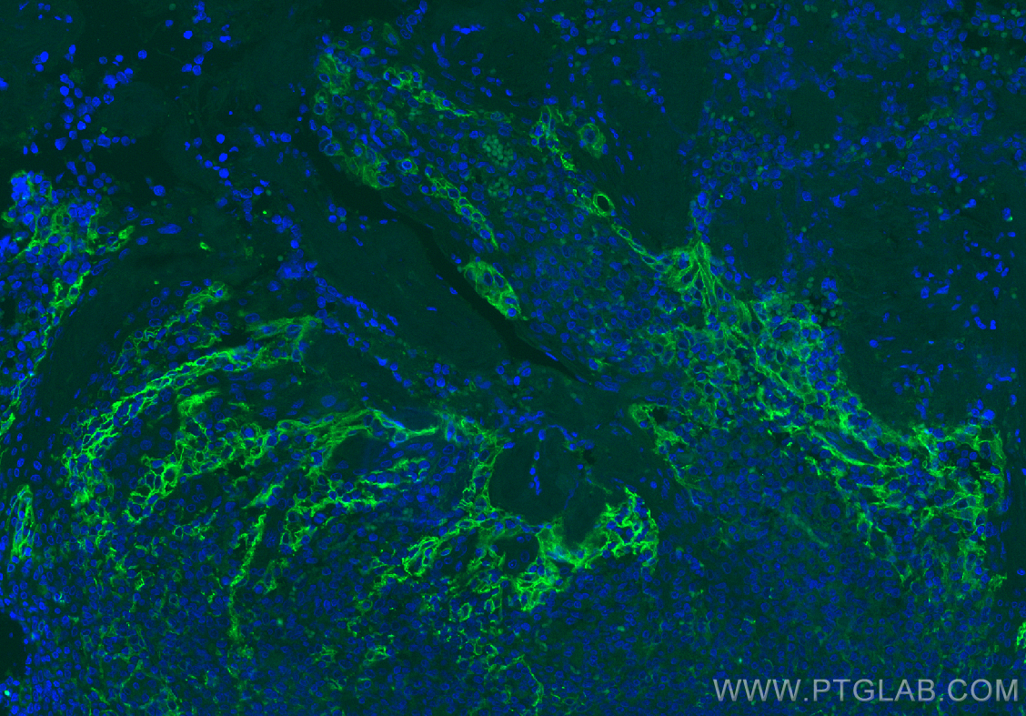 IF Staining of human tonsillitis using 82719-15-RR (same clone as 82719-15-PBS)