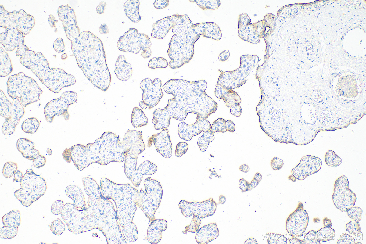 IHC staining of human placenta using 82719-15-RR (same clone as 82719-15-PBS)