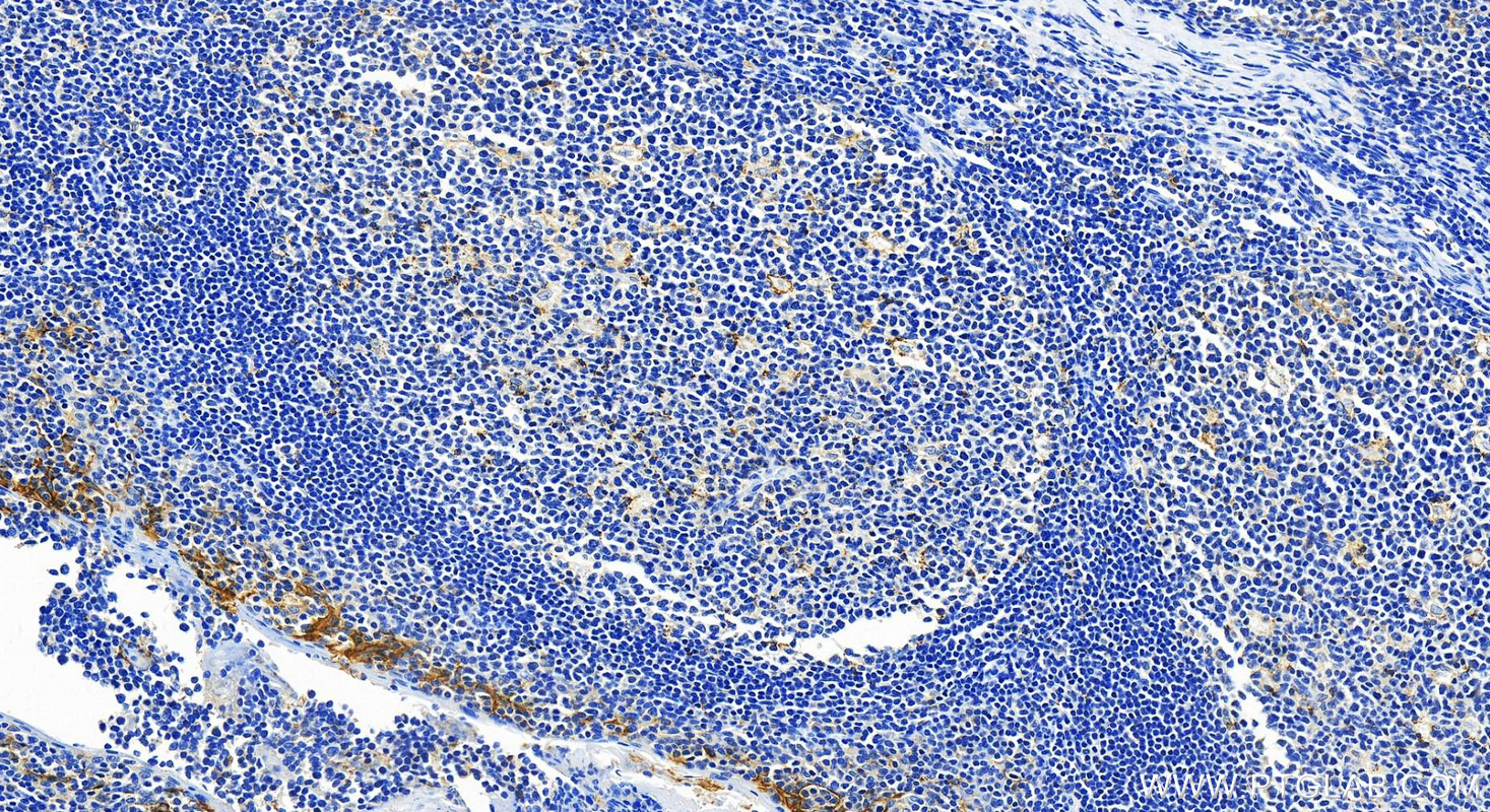 IHC staining of human tonsillitis using 82719-15-RR (same clone as 82719-15-PBS)