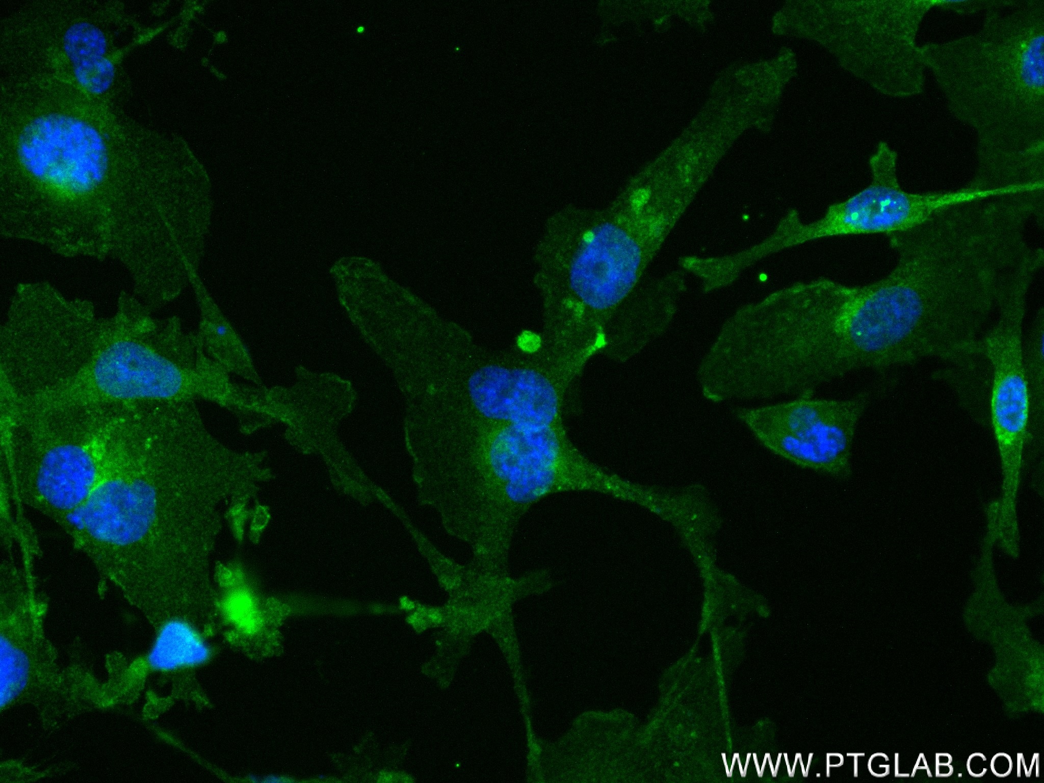 IF Staining of MDA-MB-231 using 83600-2-RR