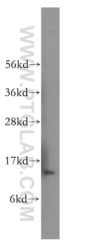 WB analysis of human heart using 12456-1-AP